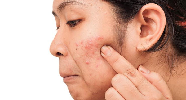 Are you comfortable in your skin? Back to School Skincare | Mr Vitamins