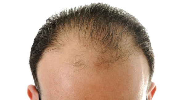 Healthy Hair Growth Fact Sheet | Mr Vitamins