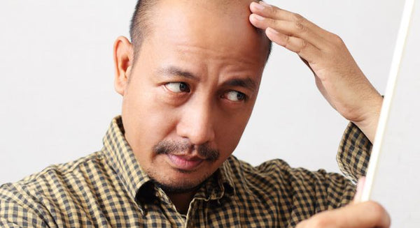 How can you support your hair growth naturally­? | Mr Vitamins