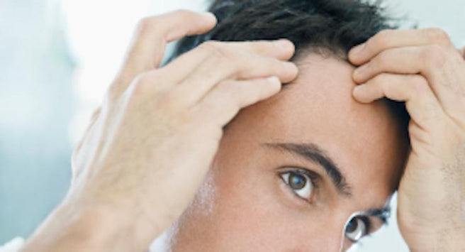 How do you stop Hair Loss and encourage Hair Growth? | Mr Vitamins
