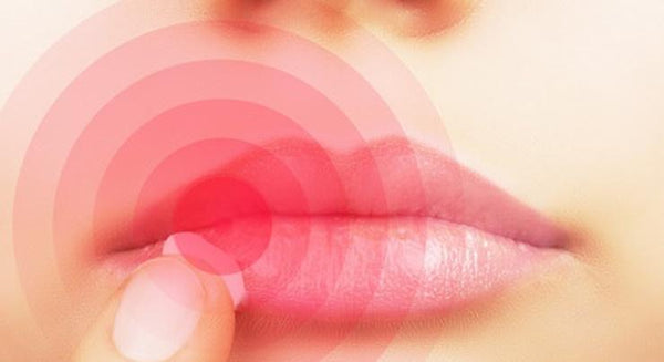 Take control of cold sores | Mr Vitamins