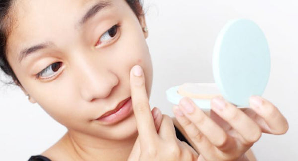 Teenage Acne and Problem Skin Solutions | Mr Vitamins
