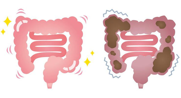 Why does your child need a Kids' Probiotic? | Mr Vitamins